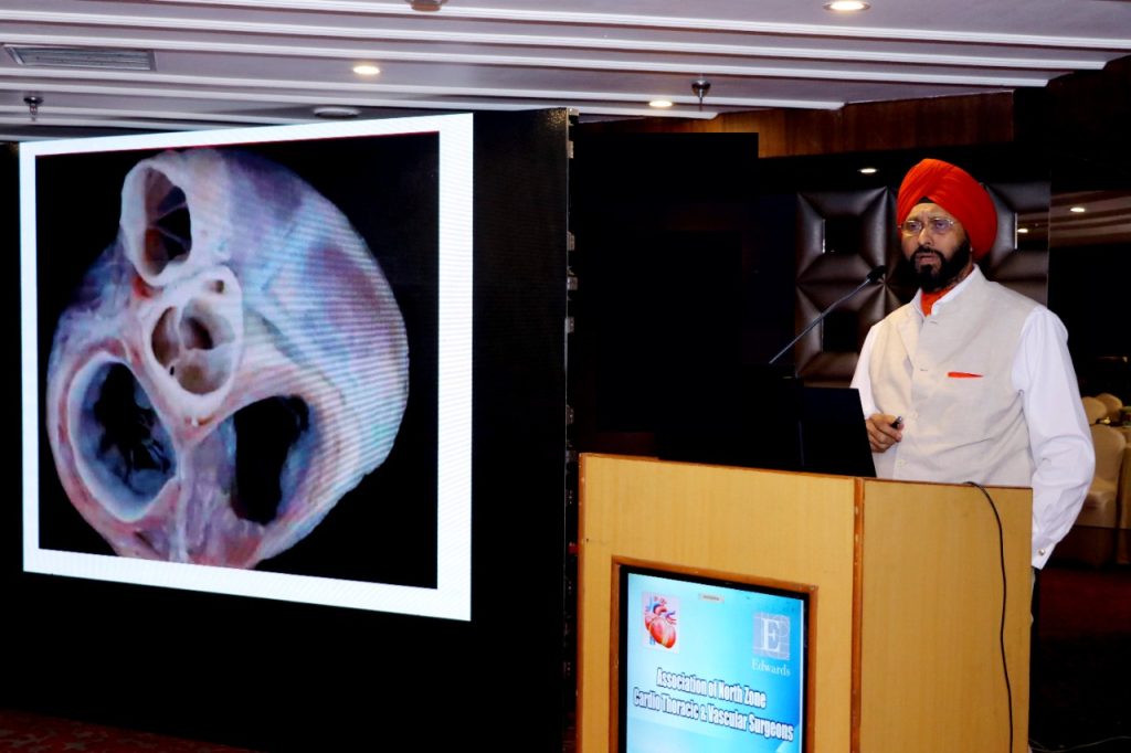 Difficult heart surgery-Indian cardiac surgeon proposed new technique to improve safety 