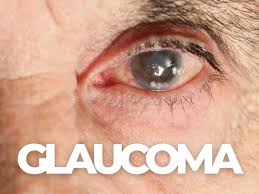Punjab health department to organize one week free Glaucoma check-up camps throughout Punjab-Dr Balbir Singh-Photo courtesy-Internet 
